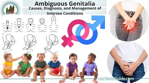 ambiguous genitalia vs intersex.